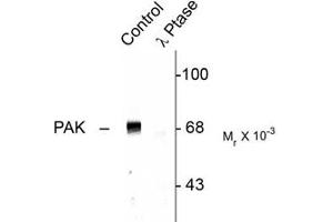 PAK1/2/3 抗体  (pThr423)