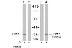Image no. 2 for anti-Heat Shock 27kDa Protein 1 (HSPB1) (pSer15) antibody (ABIN196895) (HSP27 抗体  (pSer15))