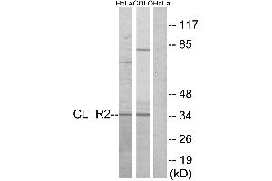 Western blot analysis of extracts from HeLa cells and COLO cells, using CLTR2 antibody. (CasLTR2 抗体  (Internal Region))