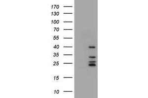 Image no. 2 for anti-Membrane-Spanning 4-Domains, Subfamily A, Member 1 (MS4A1) antibody (ABIN1497205) (CD20 抗体)