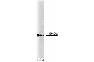 Western blot analysis of Cofilin on mouse cerebrum lysate. (Cofilin 抗体  (AA 3-98))