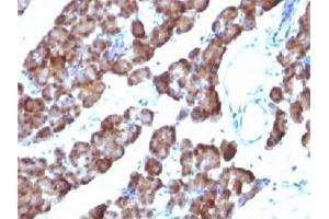 Immunohistochemistry (IHC) image for anti-Ornithine Decarboxylase 1 (ODC1) antibody (ABIN3026477)