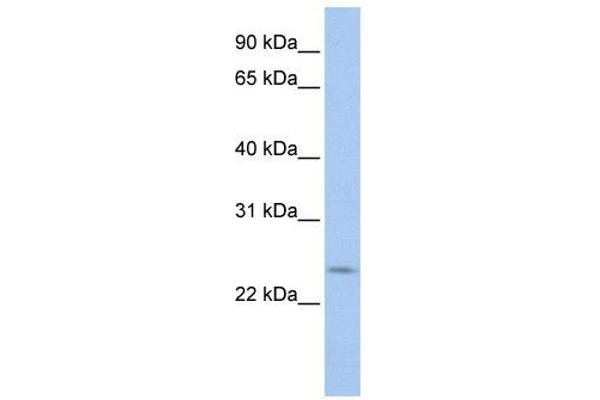 PRELID2 抗体  (C-Term)