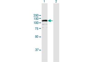 Western Blot analysis of CIZ1 expression in transfected 293T cell line by CIZ1 MaxPab polyclonal antibody. (CIZ1 抗体  (AA 1-818))
