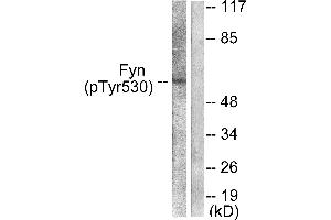 Western blot analysis of extracts from 293 cells, treated with H2O2 (100uM, 15mins), using Fyn (Phospho-Tyr530) antibody (#A0430). (FYN 抗体  (pTyr530))