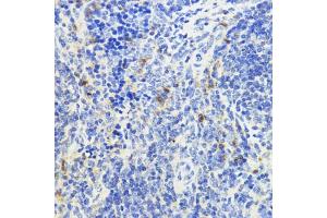 Immunohistochemistry of paraffin-embedded mouse spleen using IL10 antibody (ABIN3023111, ABIN3023112, ABIN3023113 and ABIN6219394) at dilution of 1:200 (40x lens). (IL-10 抗体  (AA 19-178))