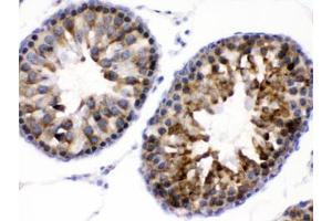 IHC testing of FFPE rat testis with WNK1 antibody. (WNK1 抗体)