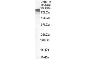 Western Blotting (WB) image for anti-Ezrin (EZR) antibody (ABIN5886568) (Ezrin 抗体)