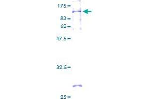 SPAG8 Protein (AA 1-501) (GST tag)