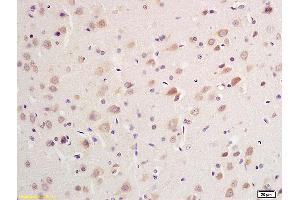 Immunohistochemistry (IHC) image for anti-K-Cadherin (CDH6) (AA 281-380) antibody (ABIN715286)