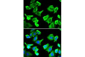 Immunofluorescence analysis of  cells using HSP27/HSP27/HSPB1 antibody (ABIN6128036, ABIN6142051, ABIN6142053 and ABIN6217766). (HSP27 抗体  (AA 1-100))