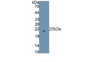 Detection of Recombinant FGF2, Rat using Polyclonal Antibody to Fibroblast Growth Factor 2, Basic (FGF2) (FGF2 抗体)