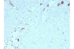 Formalin-fixed, paraffin-embedded human Uterus stained with ATG5 Mouse Monoclonal Antibody (rATG5/2553). (Recombinant ATG5 抗体  (AA 1-119))