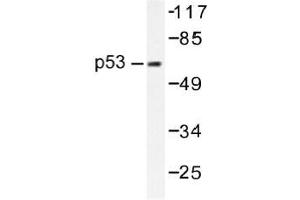 Image no. 1 for anti-Tumor Protein P53 (TP53) antibody (ABIN317853) (p53 抗体)