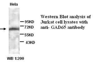 Image no. 1 for anti-Glutamate Decarboxylase 2 (Pancreatic Islets and Brain, 65kDa) (GAD2) antibody (ABIN790972) (GAD65 抗体)