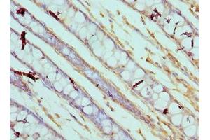 Immunohistochemistry of paraffin-embedded human colon tissue using ABIN7146544 at dilution of 1:100 (Calpain 3 抗体  (AA 582-821))