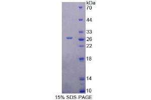 SDS-PAGE analysis of Rat YAF2 Protein. (YAF2 蛋白)