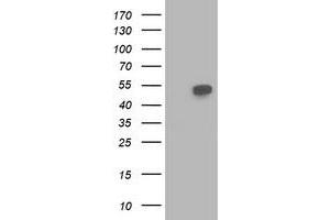 Western Blotting (WB) image for anti-Beclin 1, Autophagy Related (BECN1) antibody (ABIN1496870) (Beclin 1 抗体)