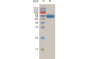 Human Protein, hFc Tag on SDS-PAGE under reducing condition. (RNF43 Protein (AA 43-197) (Fc Tag))