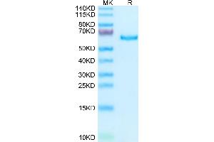 SEMA3A Protein (His tag)