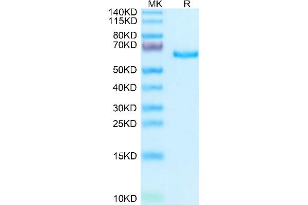 SEMA3A Protein (His tag)