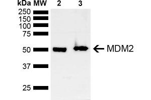 Western blot analysis of Mouse, Rat Brain showing detection of ~40 kDa MDM2 protein using Rabbit Anti-MDM2 Polyclonal Antibody (ABIN5667992). (MDM2 抗体  (AA 100-200))
