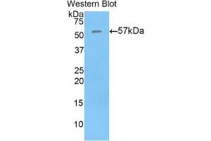 Western blot analysis of the recombinant protein. (THBS4 抗体  (AA 662-923))