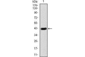 Western Blotting (WB) image for anti-Hexosaminidase A (HEXA) antibody (ABIN2970912) (Hexosaminidase A 抗体)