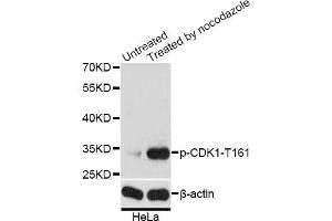 Western blot analysis of extracts of HeLa cells, using Phospho-CDK1-T161 antibody (ABIN5969957) at 1/2000 dilution. (CDK1 抗体  (pThr161))
