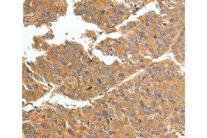 Immunohistochemistry (IHC) image for anti-Tenascin N (TNN) antibody (ABIN2432333) (Tenascin N 抗体)