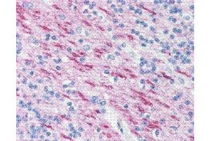 Immunohistochemistry (IHC) image for anti-Myelin Basic Protein (MBP) (AA 84-89) antibody (ABIN2475508) (MBP 抗体  (AA 84-89))