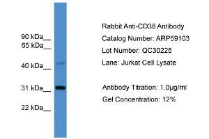WB Suggested Anti-CD38  Antibody Titration: 0. (CD38 抗体  (C-Term))