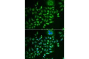 Immunofluorescence analysis of MCF-7 cells using SCG2 antibody. (SCG2 抗体)