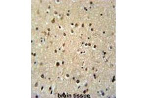 Immunohistochemistry (IHC) image for anti-threonine Synthase-Like 2 (THNSL2) antibody (ABIN3002296) (THNSL2 抗体)