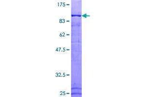 Image no. 1 for Anaphase Promoting Complex Subunit 5 (ANAPC5) (AA 1-755) protein (GST tag) (ABIN1345038) (ANAPC5 Protein (AA 1-755) (GST tag))