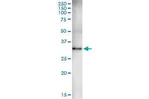 Immunoprecipitation of KYNU transfected lysate using rabbit polyclonal anti-KYNU and Protein A Magnetic Bead (KYNU (人) IP-WB Antibody Pair)