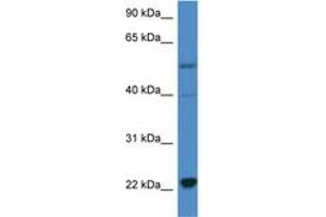 Image no. 1 for anti-Interleukin 18 (IL18) (C-Term) antibody (ABIN6746899) (IL-18 抗体  (C-Term))