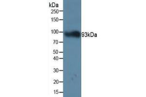 Western Blotting (WB) image for Periostin (POSTN) ELISA Kit (ABIN6574325)