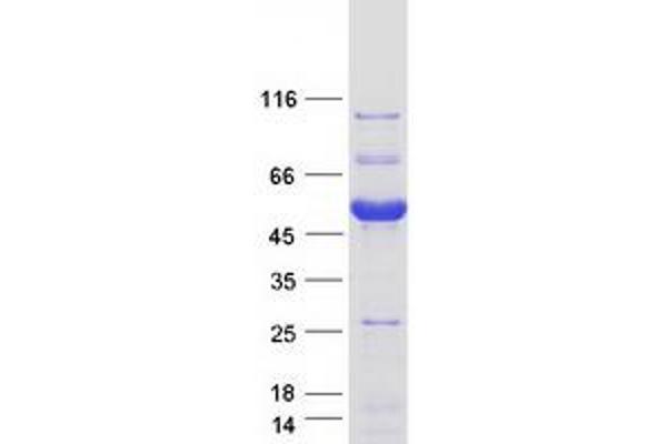 PRAS40 Protein (Transcript Variant 1) (Myc-DYKDDDDK Tag)