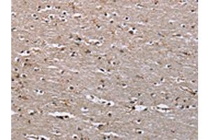The image on the left is immunohistochemistry of paraffin-embedded Human brain tissue using ABIN7191114(IQCJ Antibody) at dilution 1/30, on the right is treated with synthetic peptide. (IQCJ 抗体)