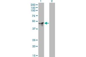 Western Blotting (WB) image for anti-Cytohesin 2 (CYTH2) (AA 314-398) antibody (ABIN564002)