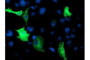 Immunofluorescence (IF) image for anti-Cerebral Cavernous Malformation 2 (CCM2) antibody (ABIN1497135) (CCM2 抗体)