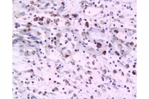 Immunohistochemistry (Paraffin-embedded Sections) (IHC (p)) image for anti-Platelet-Activating Factor Receptor (PTAFR) (AA 231-342) antibody (ABIN687127)