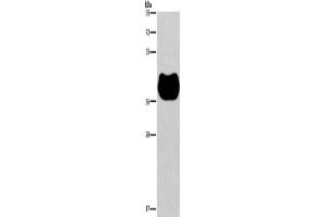 Western Blotting (WB) image for anti-Histamine Receptor H2 (HRH2) antibody (ABIN2434781) (HRH2 抗体)