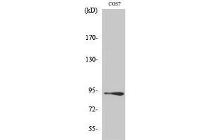 Western Blotting (WB) image for anti-Catenin, beta (CATNB) (Ser29) antibody (ABIN3183685) (beta Catenin 抗体  (Ser29))