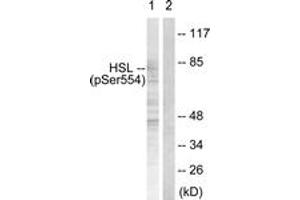 Western blot analysis of extracts from HeLa cells treated with Adriamycin 0. (LIPE 抗体  (pSer855))
