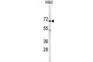 Western Blotting (WB) image for anti-Adenylate Kinase 7 (AK7) antibody (ABIN3002976) (Adenylate Kinase 7 抗体)