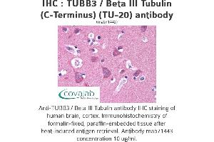 Image no. 2 for anti-Tubulin, beta 3 (TUBB3) (N-Term) antibody (ABIN1724161) (TUBB3 抗体  (N-Term))