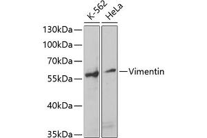 Western blot analysis of extracts of various cell lines, using Vimentin antibody (ABIN3016291, ABIN3016292, ABIN3016293 and ABIN6219693) at 1:1000 dilution. (Vimentin 抗体  (AA 1-200))