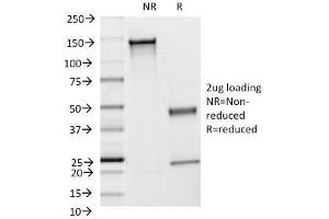 SDS-PAGE Analysis Purified CD54 Monoclonal Antibody (F4-31C2). (ICAM1 抗体)